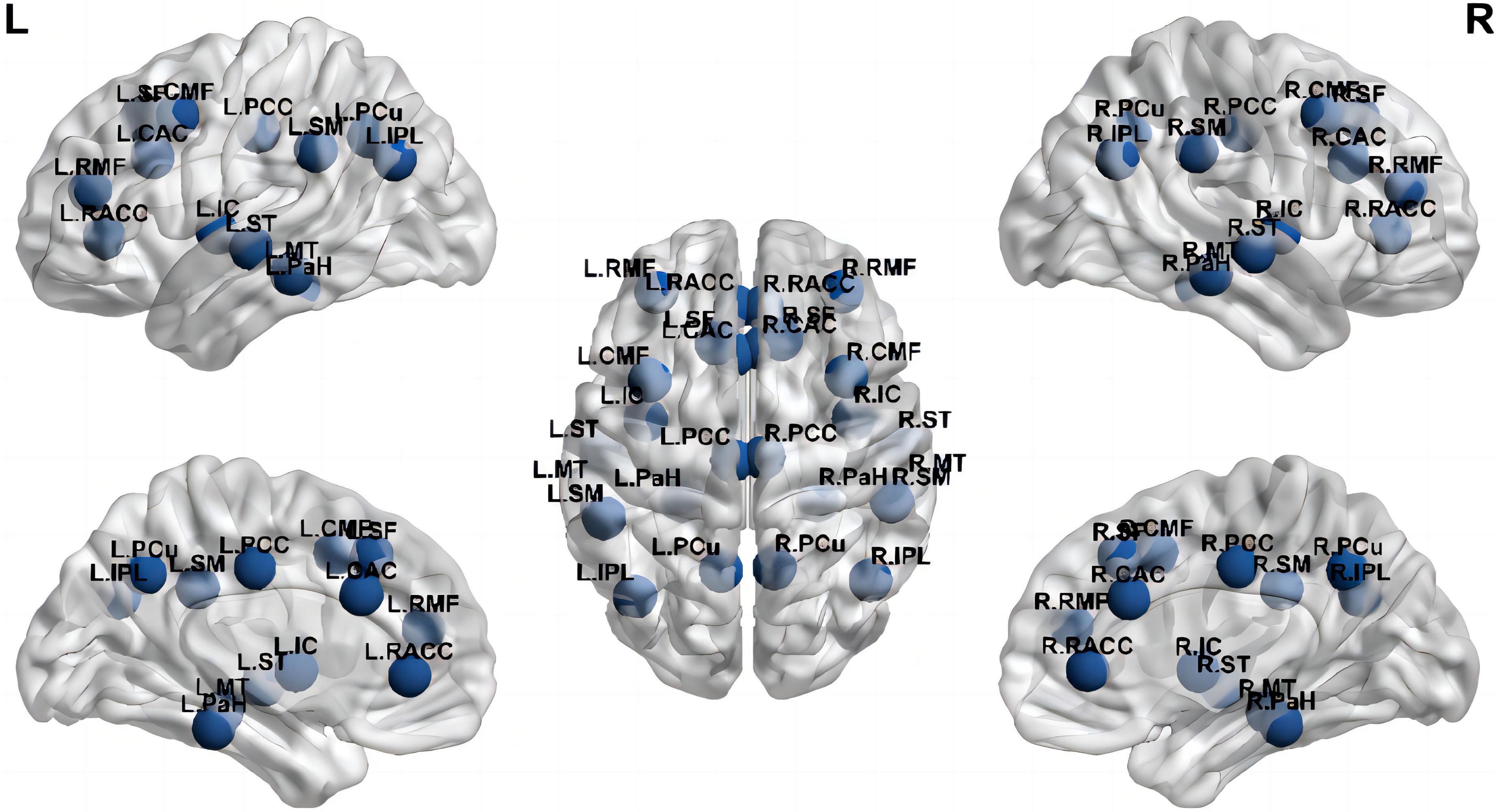 Alternations of neuromagnetic activity across neurocognitive core networks among benign childhood epilepsy with centrotemporal spikes: A multi-frequency MEG study